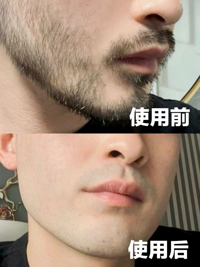 创维怒砸千万造剃须刀界“劳斯莱斯”知名企业家力荐！(图5)